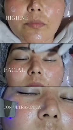 Higiene facial profunda con ultrasónica en Guapas Casa Spa